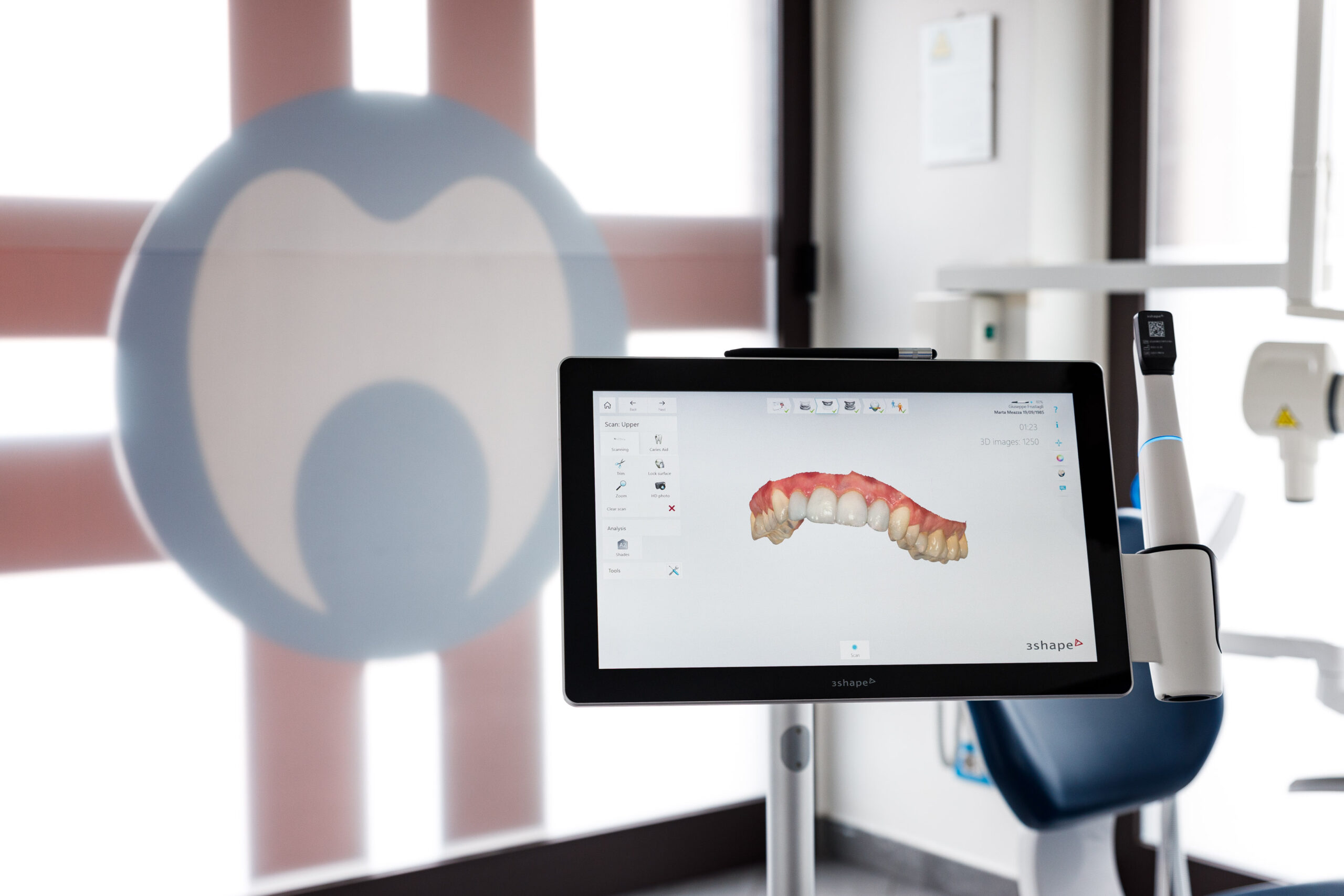 Scanner intraorale